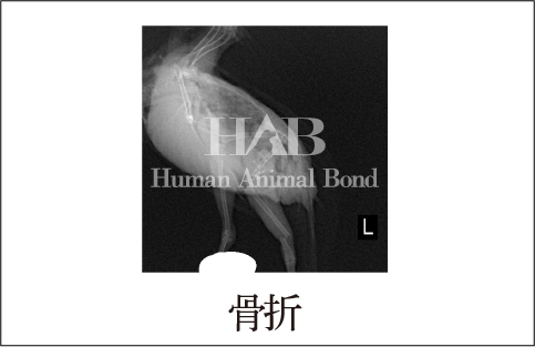 骨折