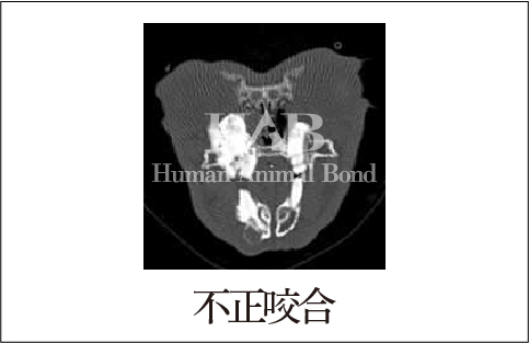 不正咬合